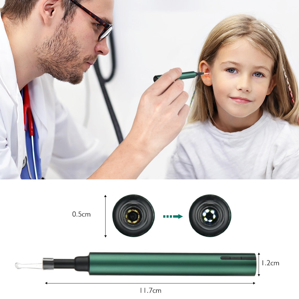 MPG Otoscope EarWax Remover