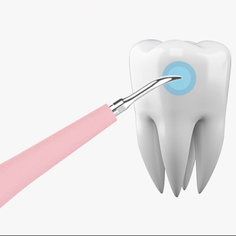 MPG Dental Calculus Plaque Remover